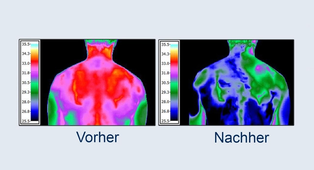 Thermografie-Aufnahme zeigt kühlenden Effekt des ASEA REDOXGold Gels auf behandelten Körperstellen